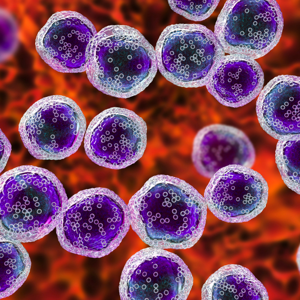 Lymphoma